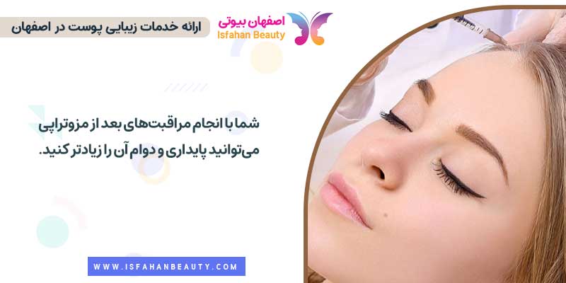 ماندگاری مزوتراپی صورت | اصفهان بیوتی