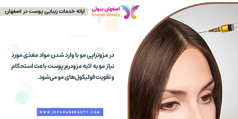 مزوتراپی مو چیست | اصفهان بیوتی