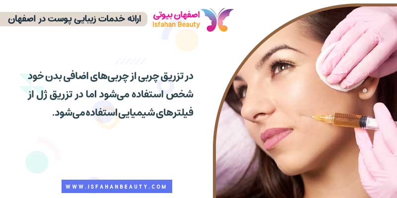 روش انجام تزریق چربی با تزریق ژل