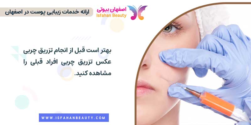 عکس تزریق چربی