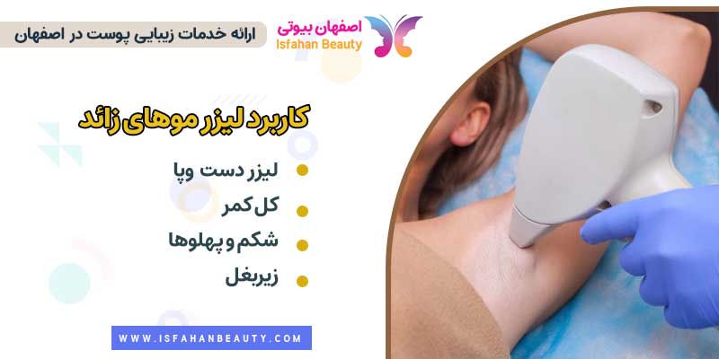 کاربرد لیزر موهای زائد | اصفهان بیوتی
