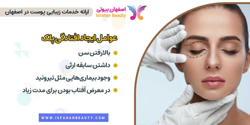 عوامل ایجاد افتادگی پلک و درمان با بلفاروپلاستی | اصفهان بیوتی