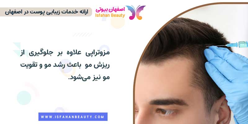  درمان ریزش مو با مزوتراپی | اصفهان بیوتی