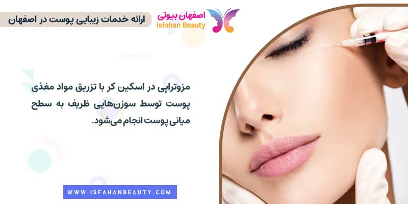 مزوتراپی در درمان اسکین کر | اصفهان بیوتی