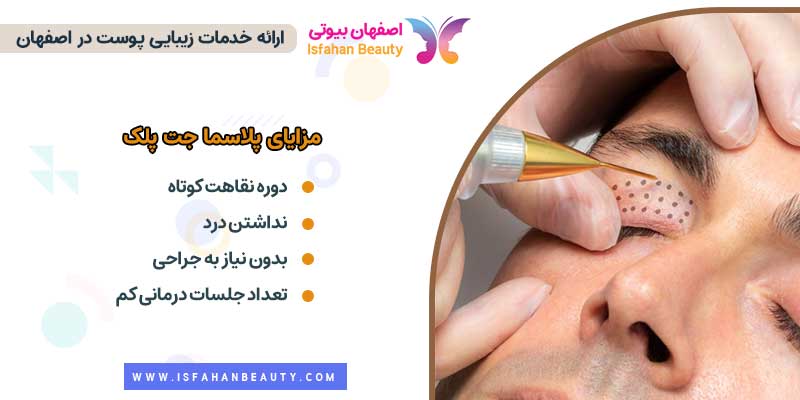 مزایای پلاسما جت پلک