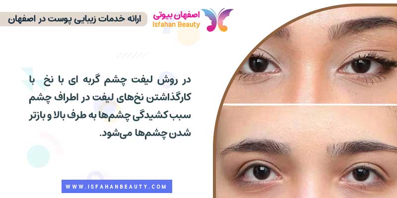 عکس لیفت چشم گربه ای با نخ