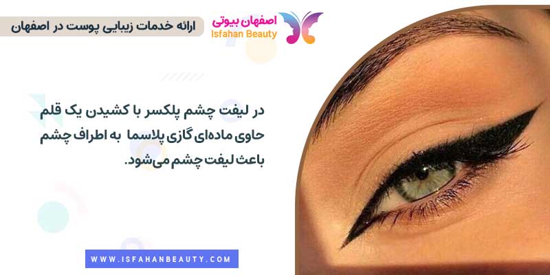 لیفت چشم گربه ای یا پلکسر پلک