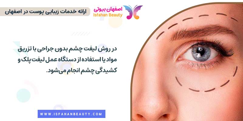 انجام لیفت چشم بدون جراحی 