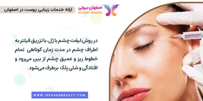 لیفت چشم با تزریق ژل 