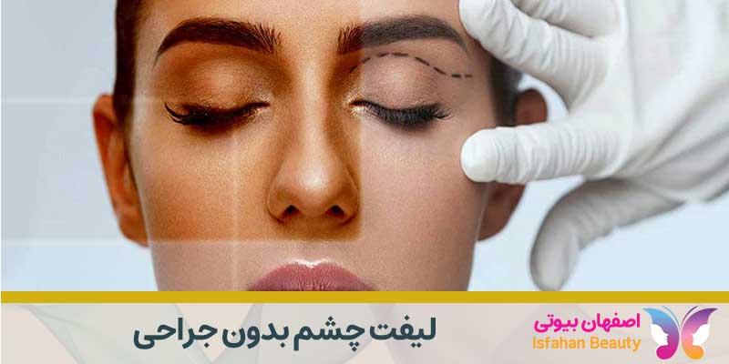 لیفت چشم بدون جراحی|
