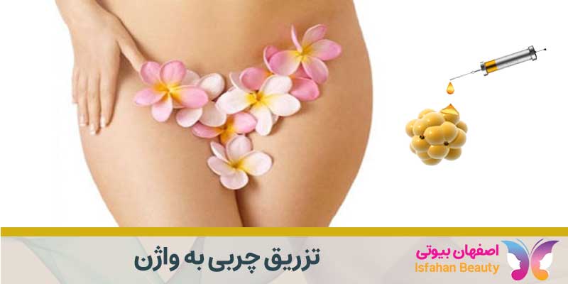 تزریق چربی به واژن | اصفهان بیوتی