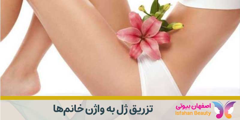 تزریق ژل به ناحیه تناسلی (واژن) بانوان | اصفهان بیوتی