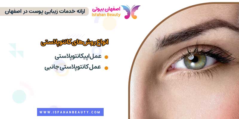 انواع روش کانتوپلاستی