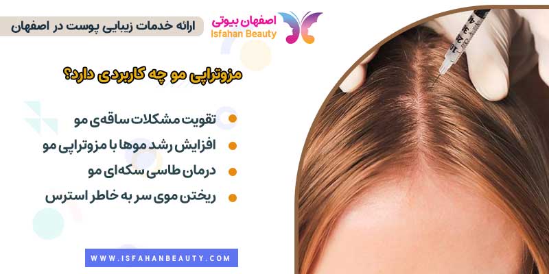 کاربرد مزوتراپی مو