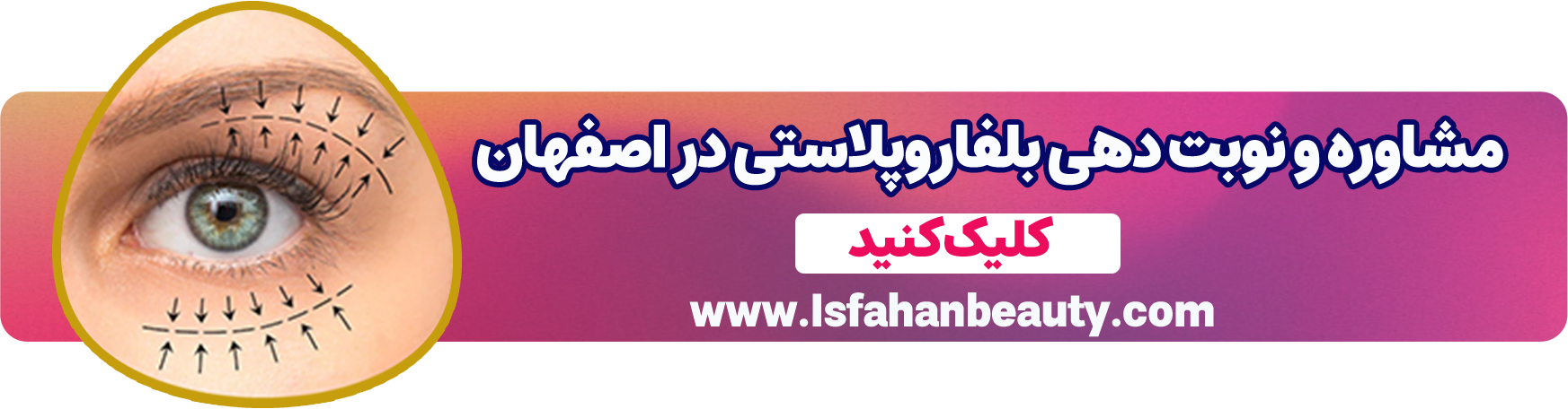 مشاوره و نوبت دهی بلفاروپلاستی | اصفهان بیوتی