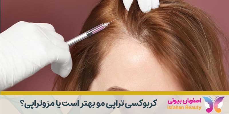 کربوکسی تراپی مو بهتر است یا مزوتراپی | اصفهان بیوتی