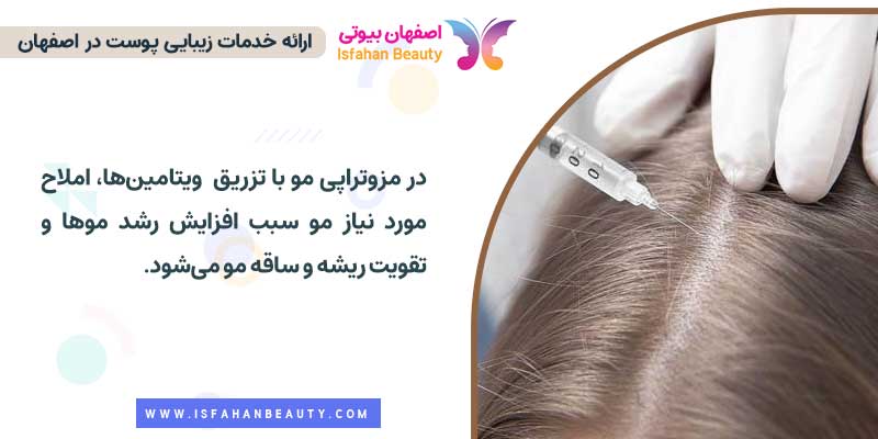روش انجام مزوتراپی مو 