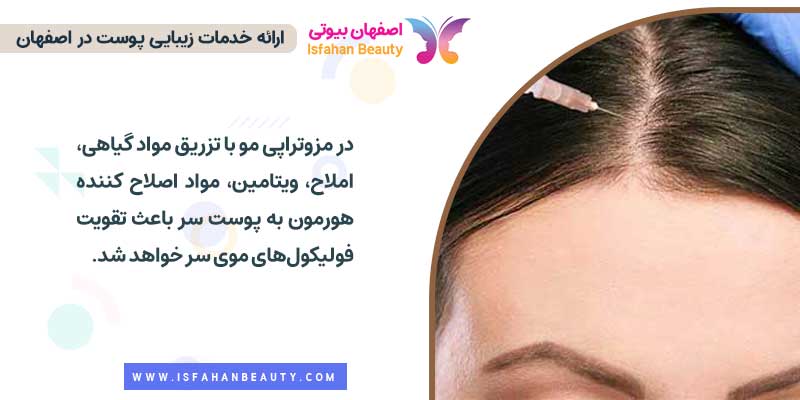مزوتراپی مو و نحوه انجام آن