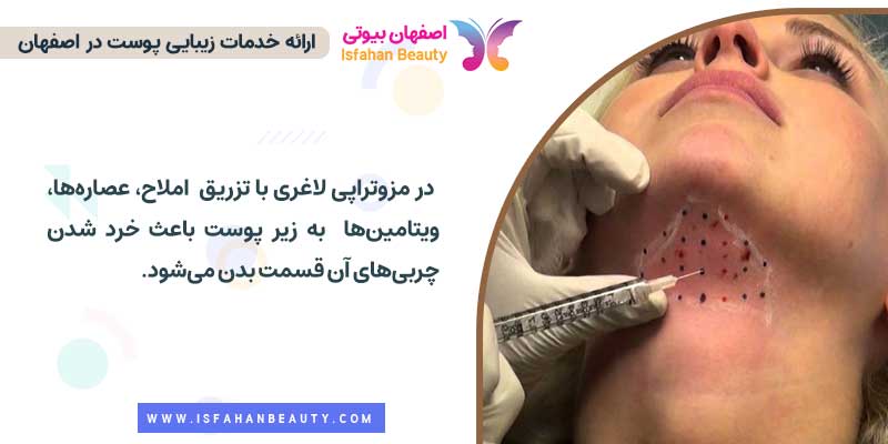 روش انجام مزوتراپی لاغری