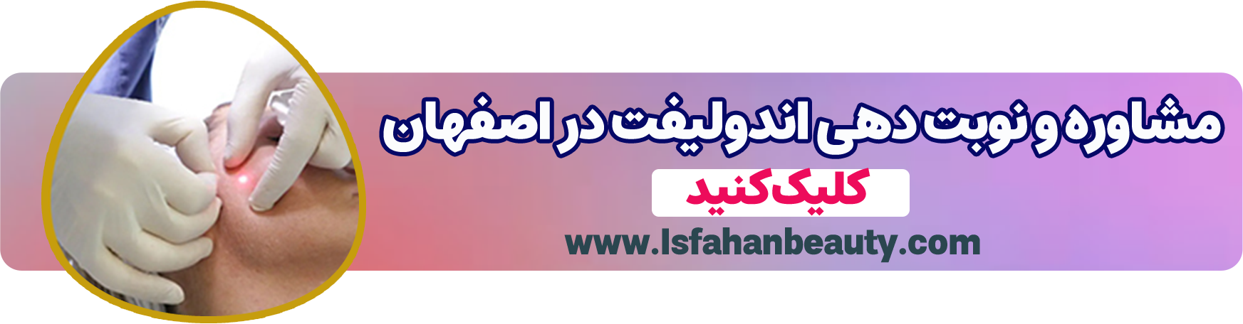 نوبت دهی اندولیفت| اصفهان بیوتی