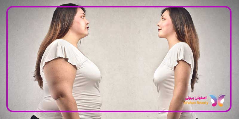 عکس قبل و بعد هایفوتراپی لاغری شکم