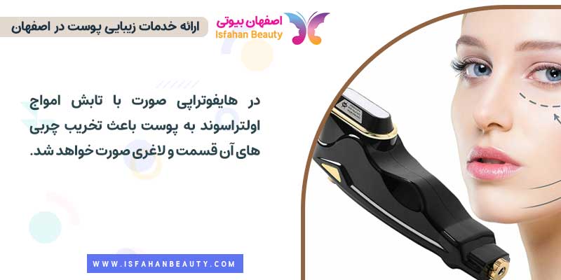 حذف چربی‌های صورت با هایفوتراپی