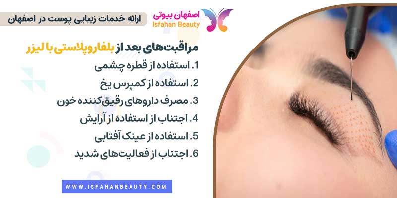 مراقبتهای بعد از بلفاروپلاستی با لیزر