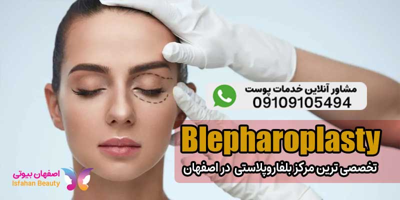 بلفاروپلاستی در اصفهان | کلینیک تخصصی سینایار