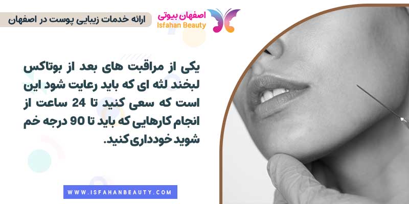 مراقبت بعد از بوتاکس لبخند لثه ای