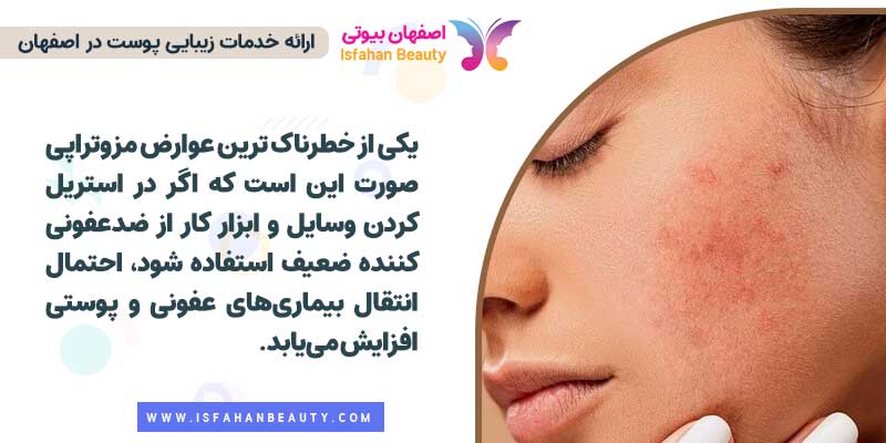 عوارض مزوتراپی صورت