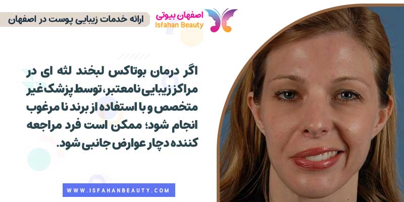 عوارض بوتاکس لبخند لثه ای