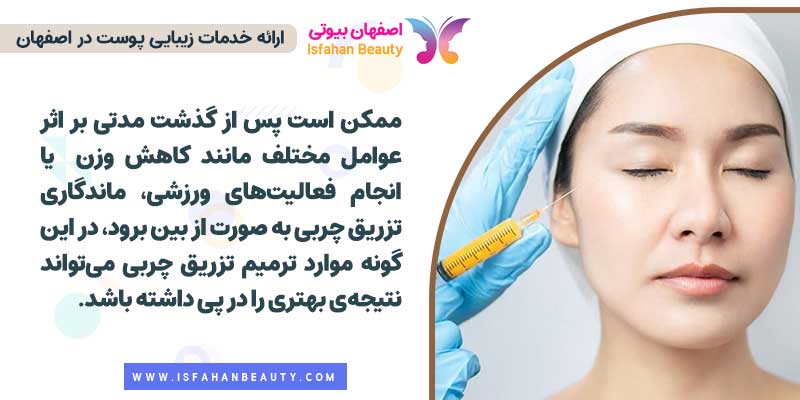 ماندگاری تزریق چربی به صورت لاغر