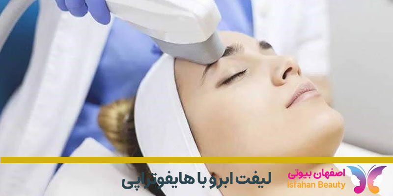 لیفت ابرو با هایفوتراپی