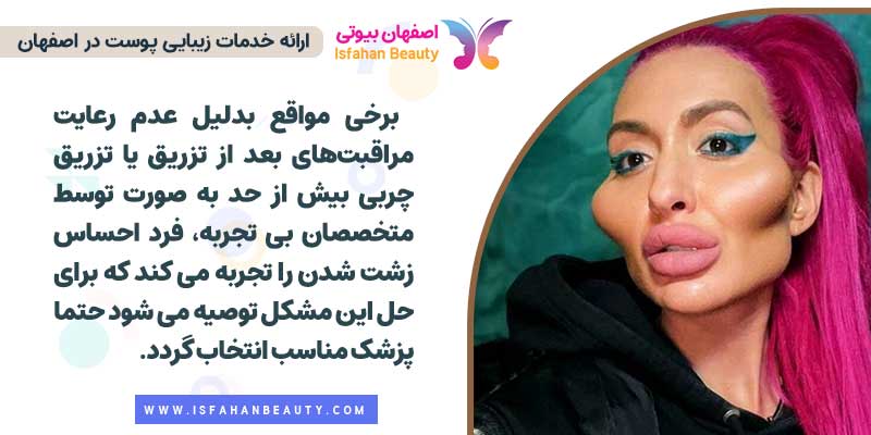 زشت شدن صورت بعد از تزریق چربی