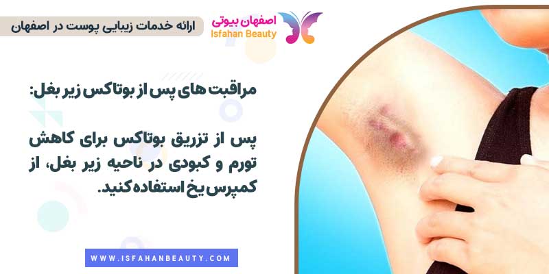 مراقبت های بعد از بوتاکس زیر بغل
