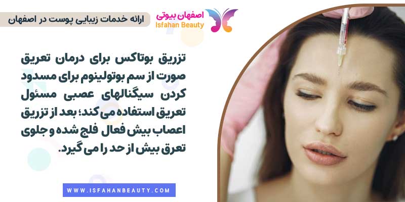 بوتاکس برای عرق صورت