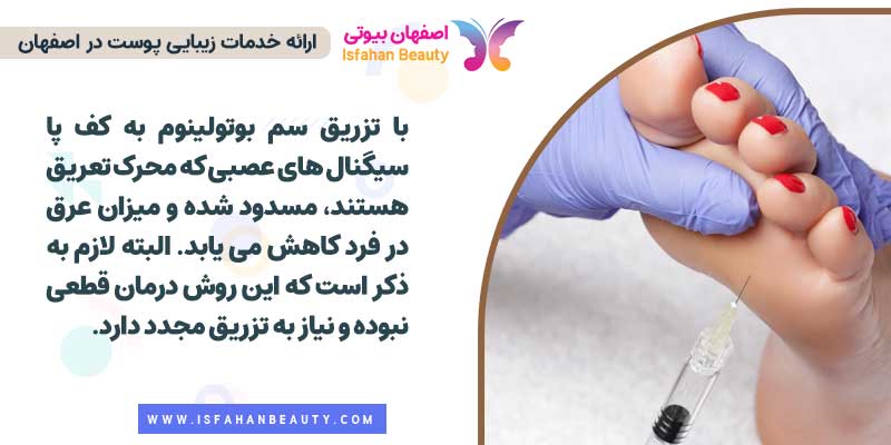 بوتاکس برای عرق پا