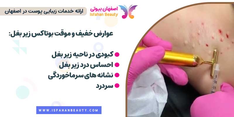 عوارض موقتی بوتاکس زیر بغل