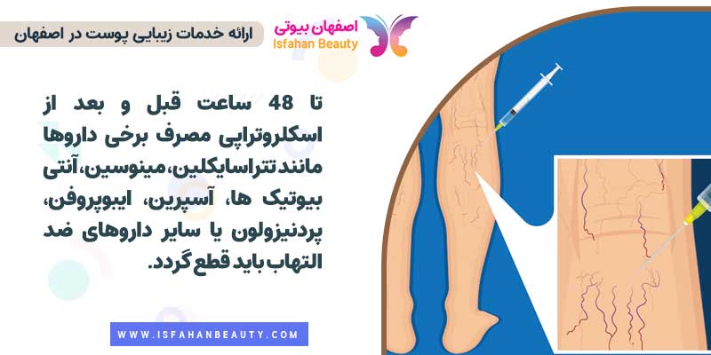 نکات مهم قبل از اسکلروتراپی