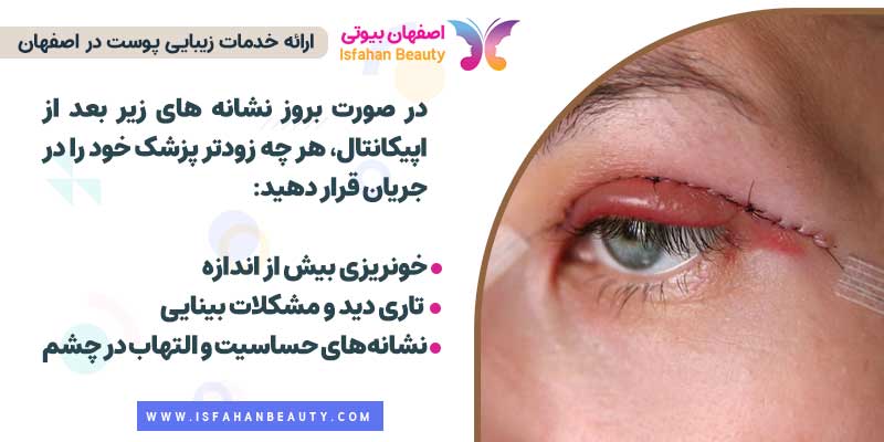 مراقبتهای بعد از اپی کانتال