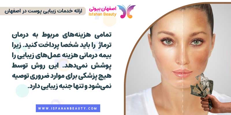 قیمت ترماژ