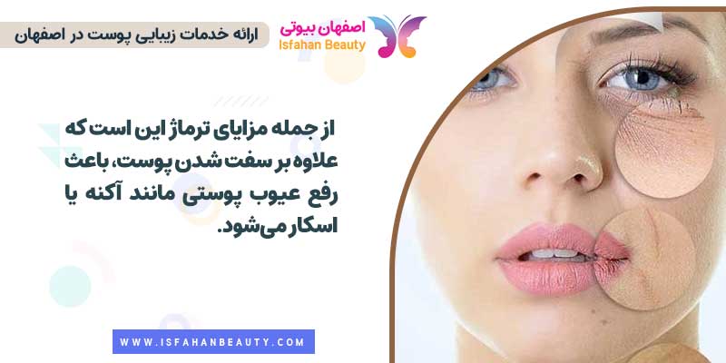مزایای ترماژ