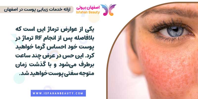 خطرات ترماژ