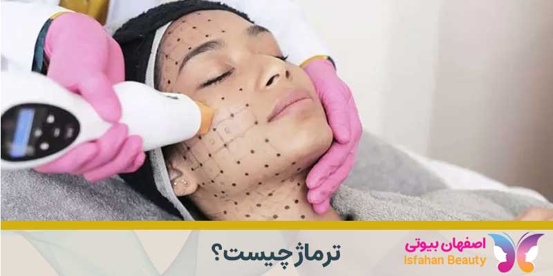 ترماژ چیست