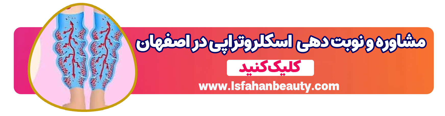 اسکلروتراپی در اصفهان