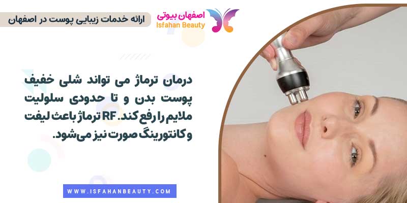 ترماژ چیست؟