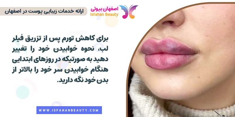 چگونه ورم ژل لب را کم کنیم؟