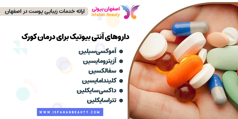 داروی کورک، آنتی بیوتیک برای از بین بردن کورک