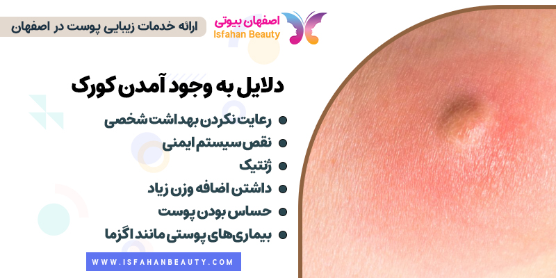 دلایل کورک، دلیل تشکیل کورک