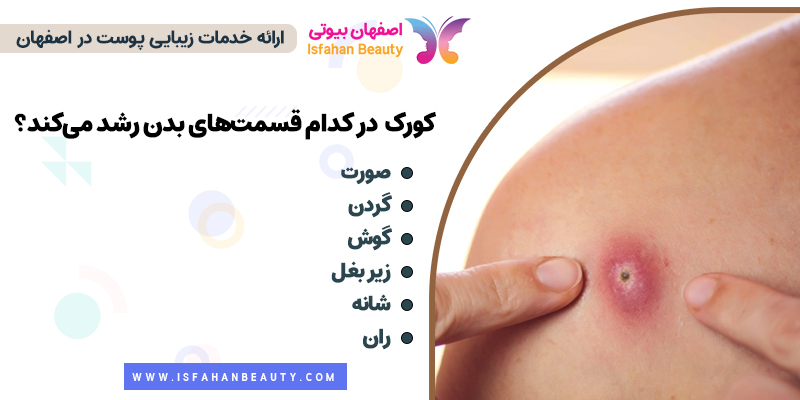 کورک کجا تشکیل میشود